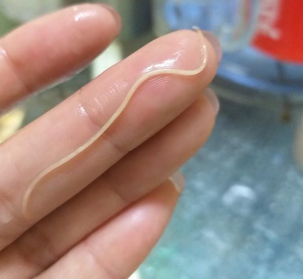 Xuất hiện clip lòng trắng trứng gà nghi bị nhiễm giun sán và nhận định của chuyên gia
