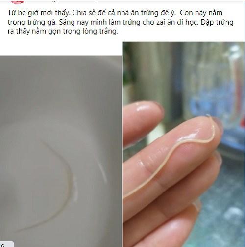 Xuất hiện clip lòng trắng trứng gà nghi bị nhiễm giun sán và nhận định của chuyên gia